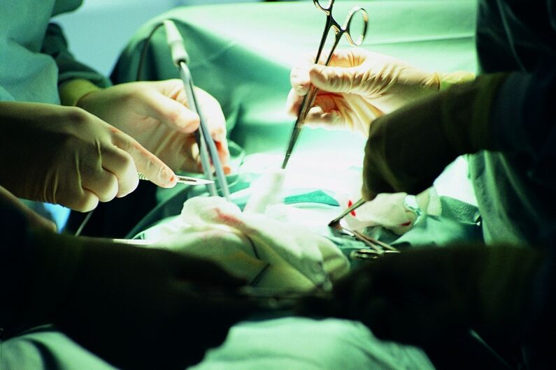 aumento quirúrgico del grosor del pene